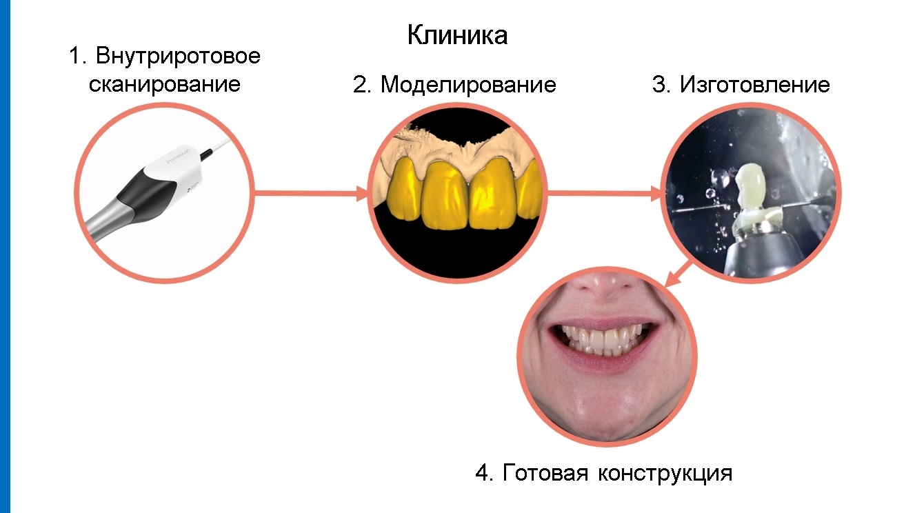 Протоколы работы в стоматологии (4)